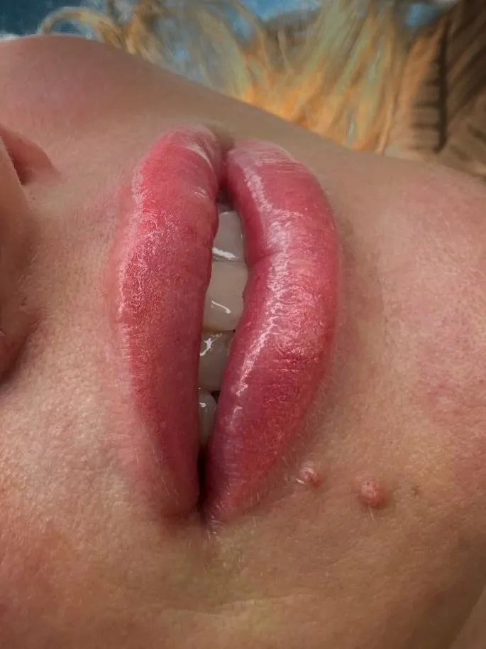 Permanent lip makeup — close-up