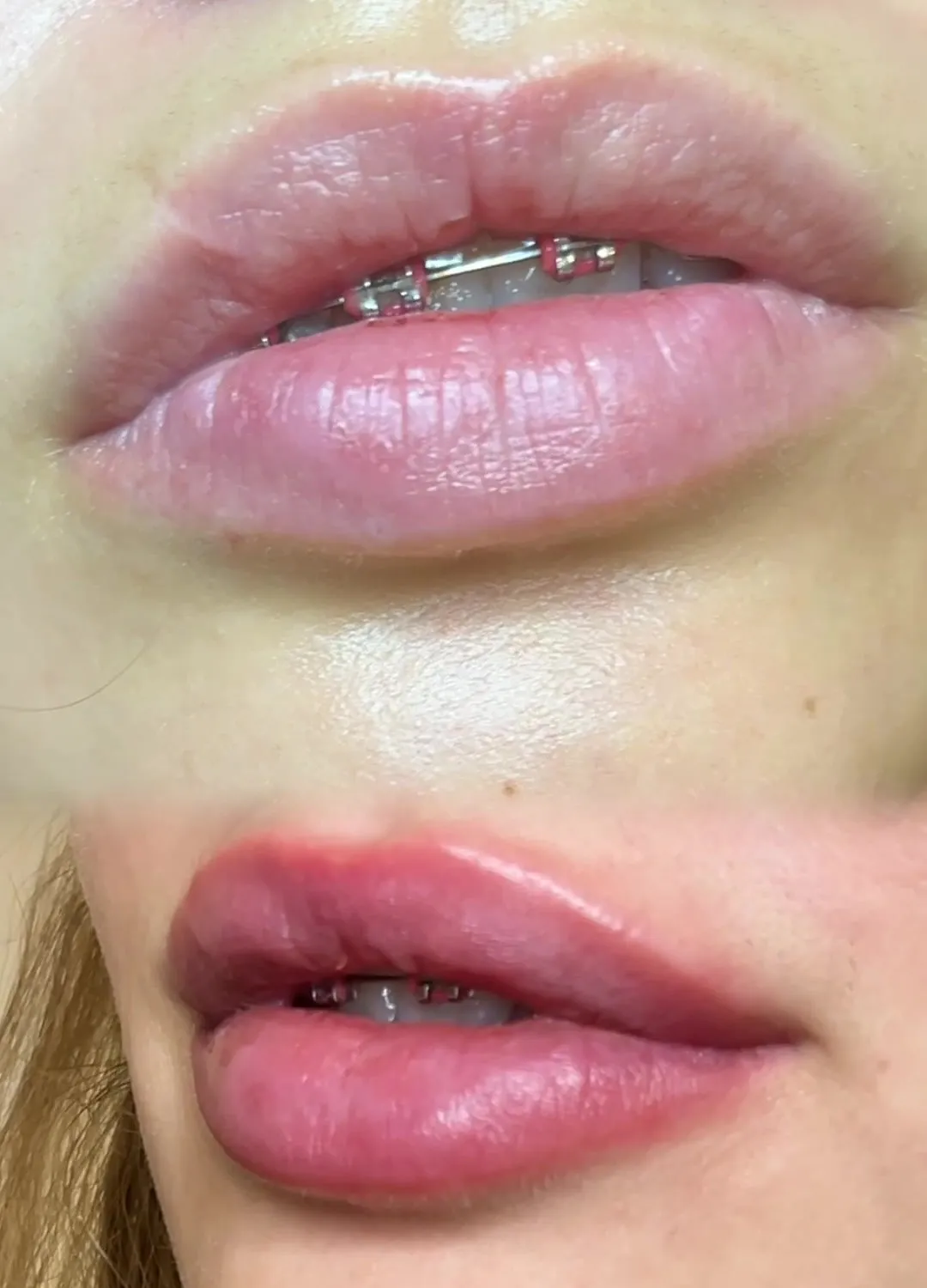 Permanent lip makeup — before and after